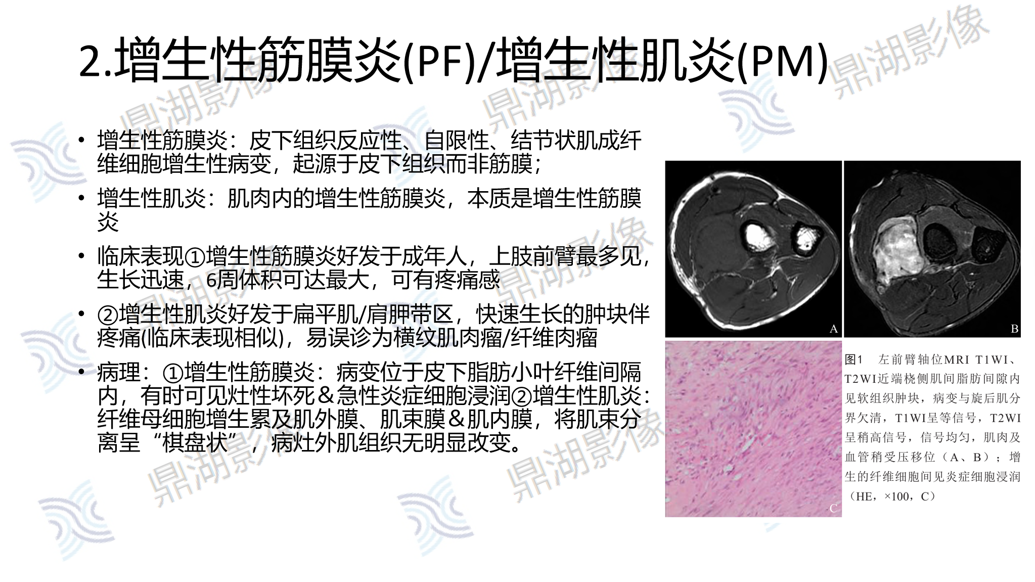 0fe78831fa7cbee090db818fe1597b3e.png 0fe78831fa7cbee090db818fe1597b3e.png