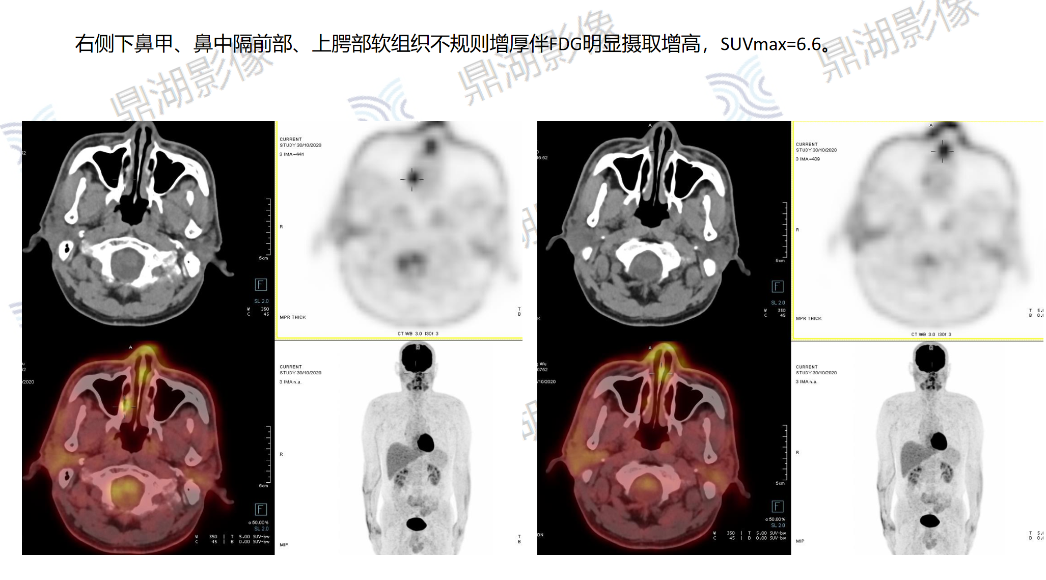 2ea5627da2e059db5ee9adcd371f30e6.png 2ea5627da2e059db5ee9adcd371f30e6.png