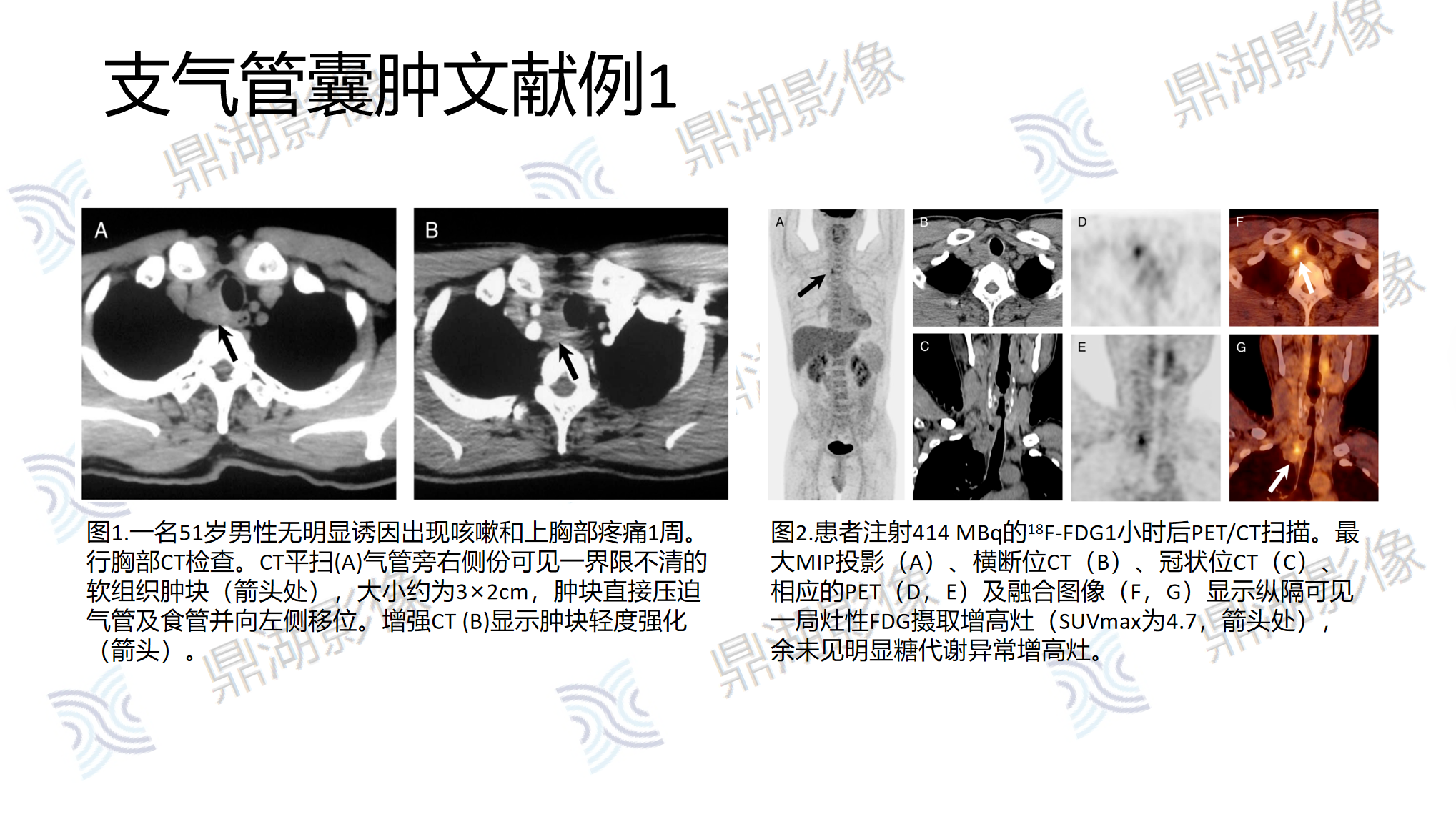 4198b61552bbf39da712c68aaf272d73.png 4198b61552bbf39da712c68aaf272d73.png