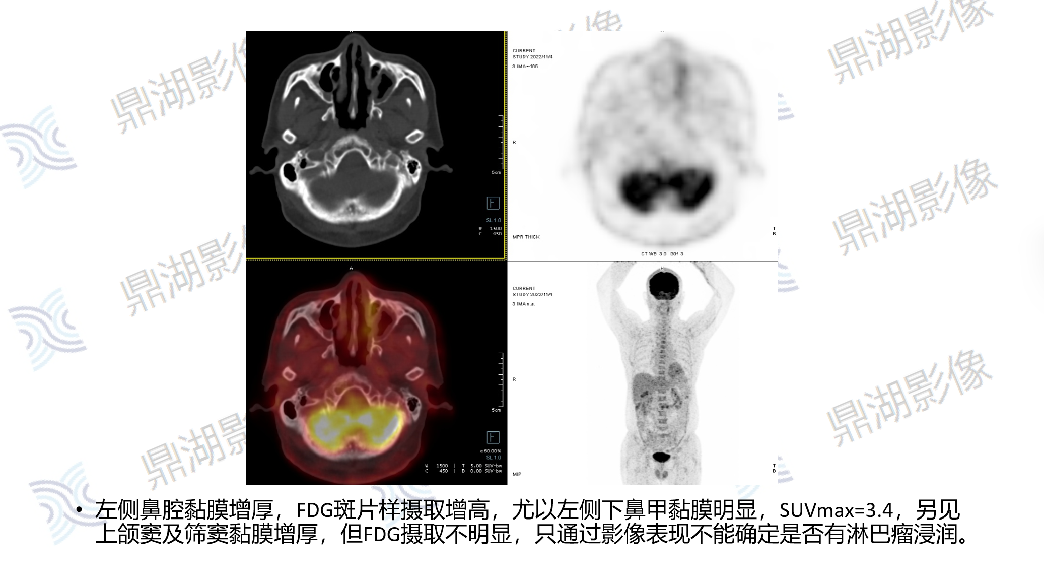 46b7e9e3cdaf1d2b65645d51f807d7ad.png 46b7e9e3cdaf1d2b65645d51f807d7ad.png