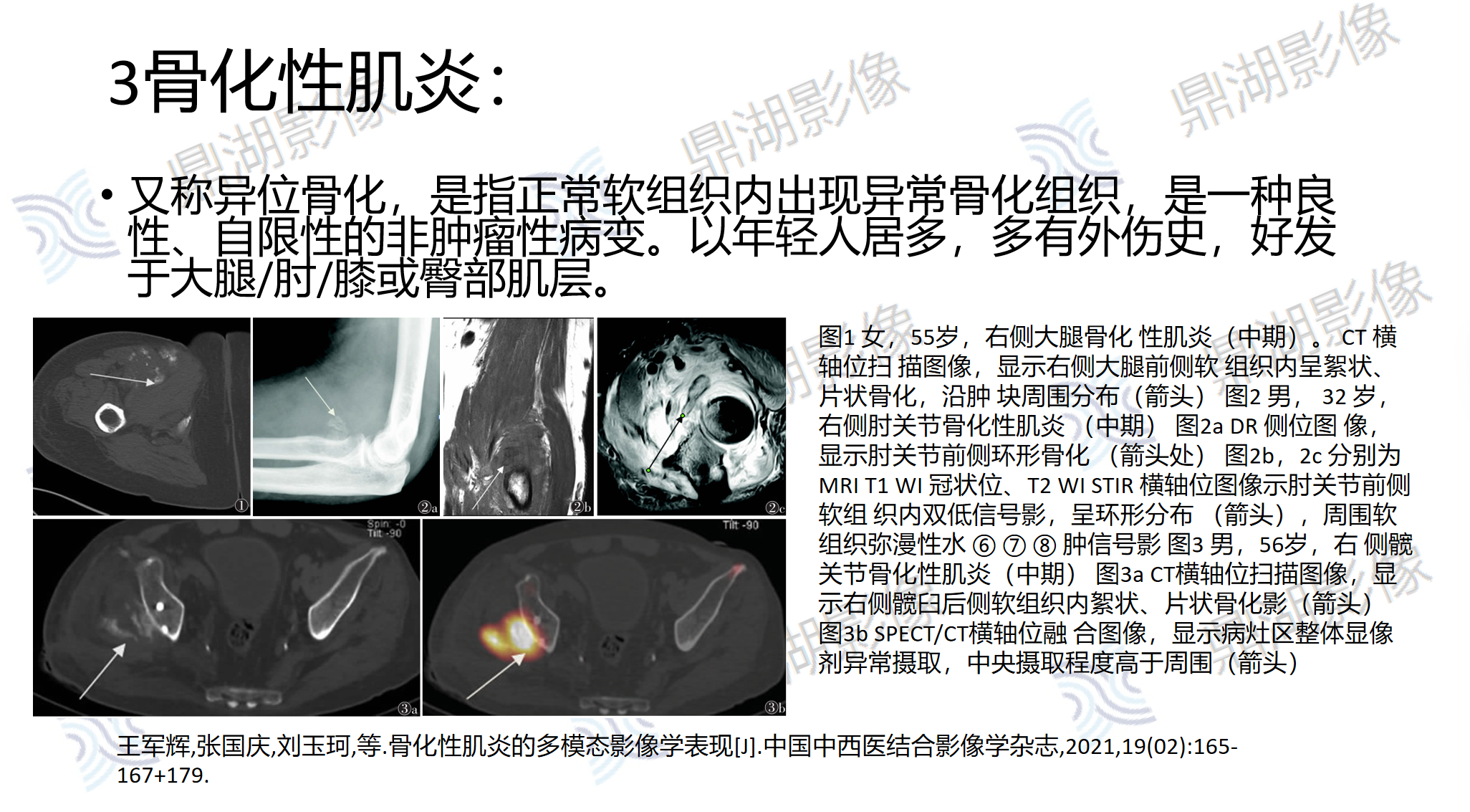 47be7ff2a13fe8e1d3035224b19d97c6.png 47be7ff2a13fe8e1d3035224b19d97c6.png