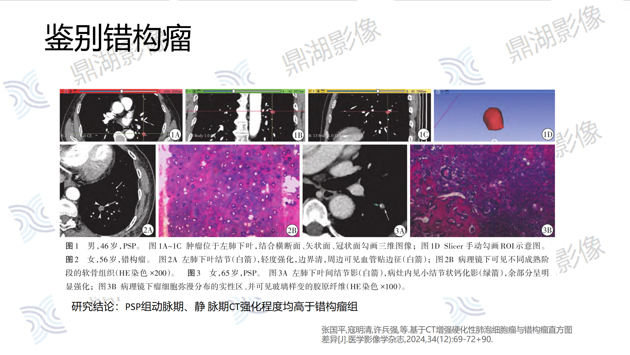 5e42318a60cf8ea4a13882d8b9fd4e2e.png