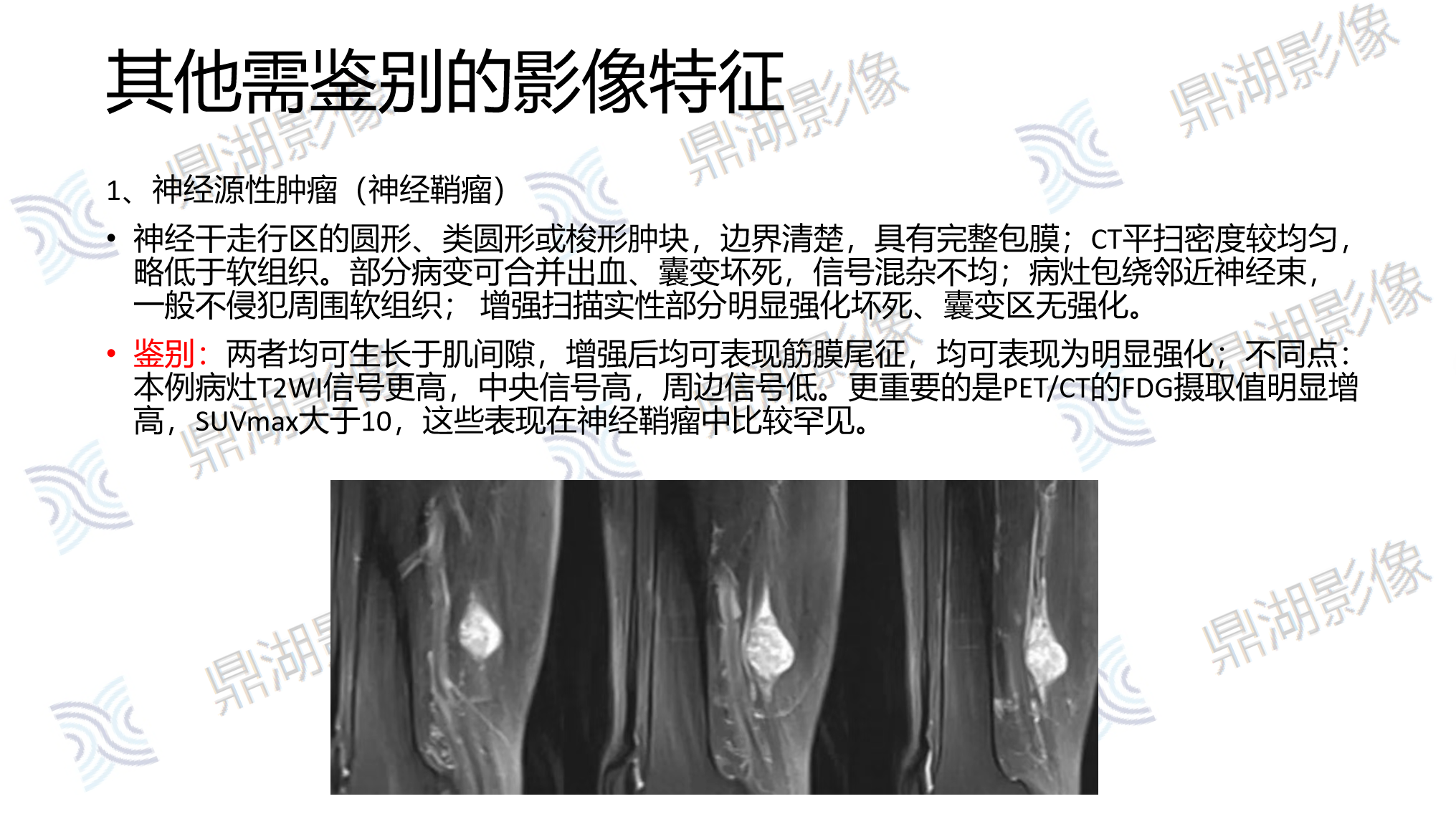 8a4c7874ccb16896c2bdddb874264f06.png 8a4c7874ccb16896c2bdddb874264f06.png