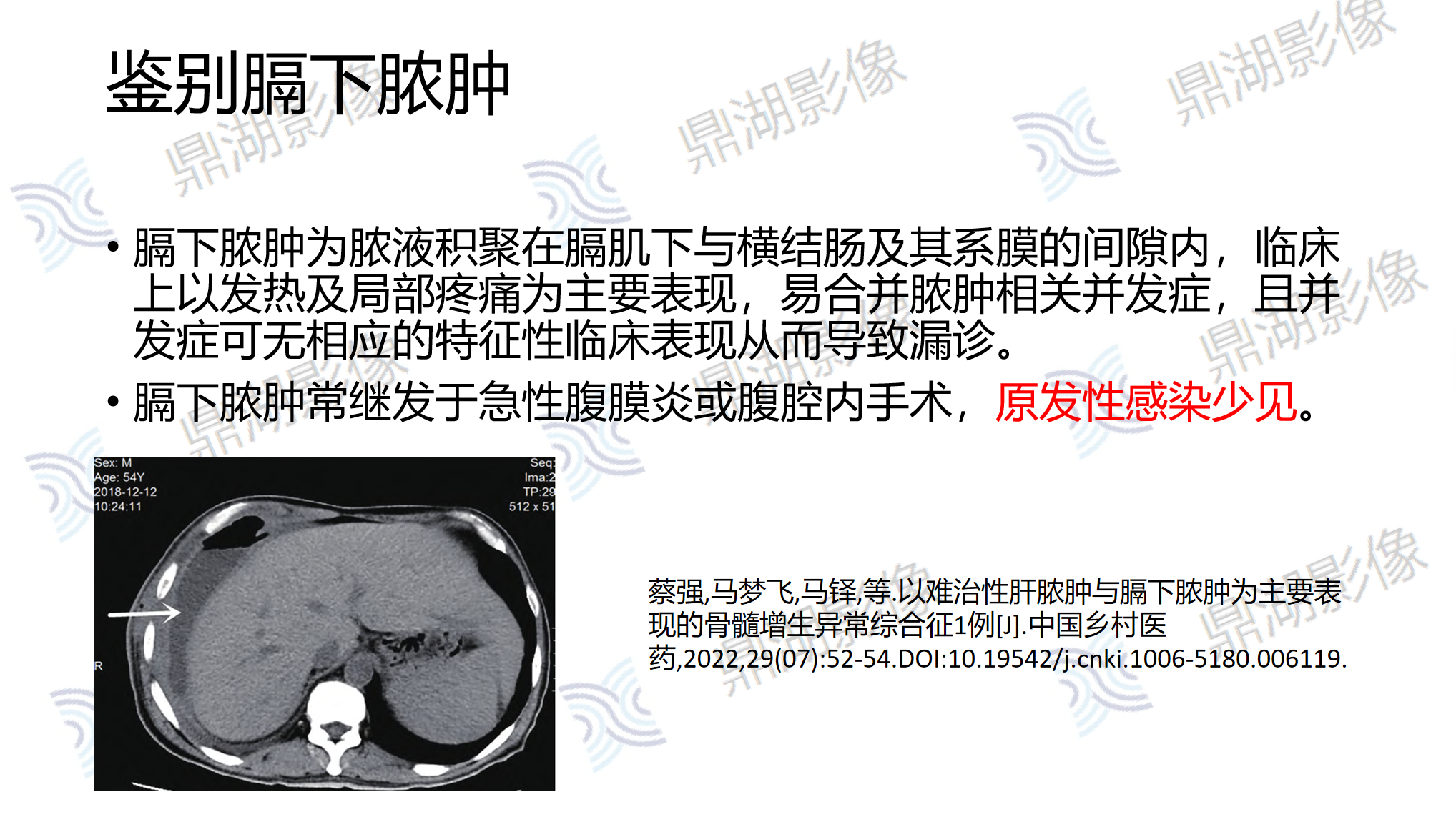 9826b0239aa258bdecb20a2f6da4ee6c.png 9826b0239aa258bdecb20a2f6da4ee6c.png