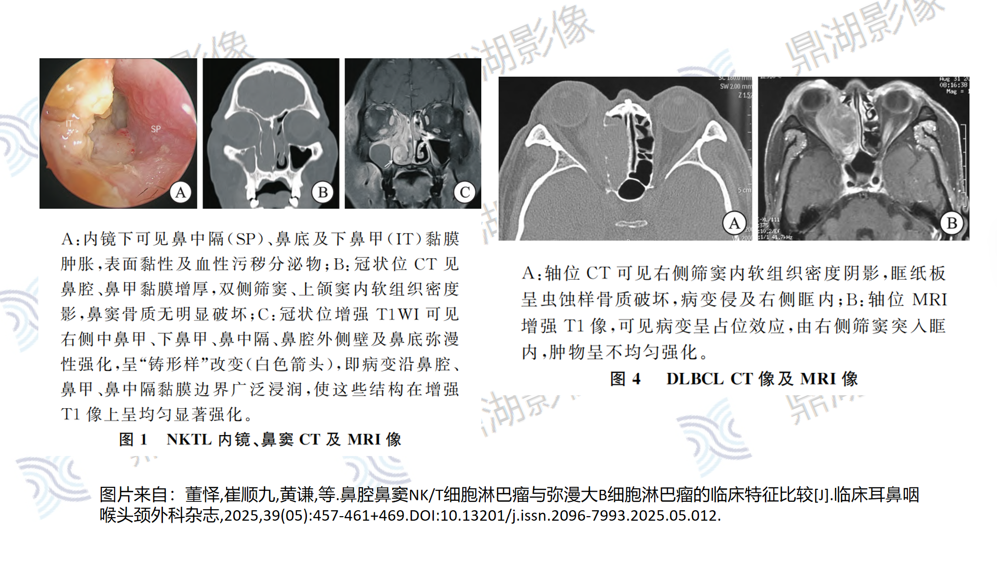 9ef6c146830aa5f0ffa971f65ff17499.png 9ef6c146830aa5f0ffa971f65ff17499.png
