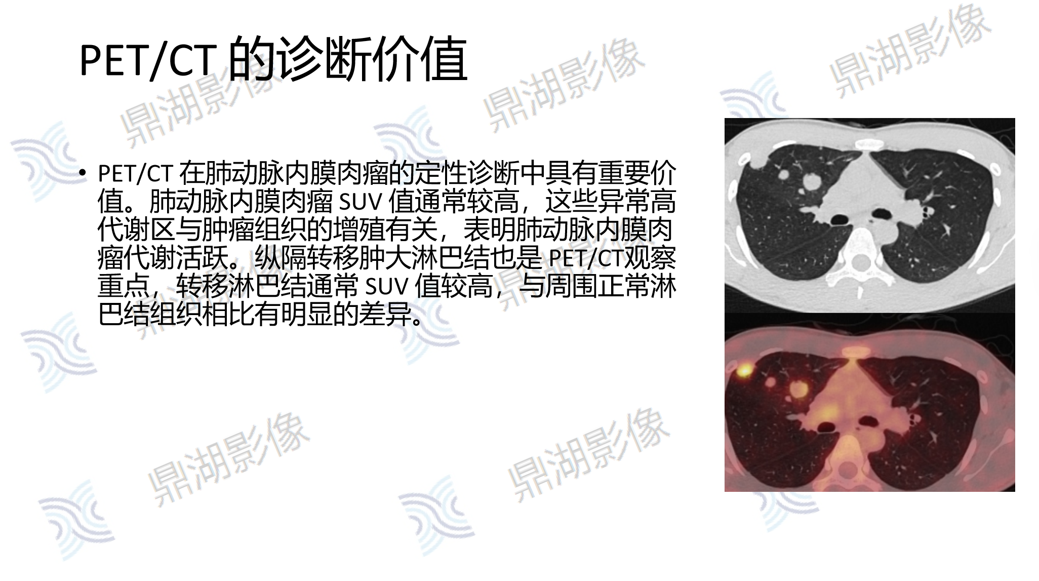 ac9e9943f2058c5e86cdb60cacb4f284.png ac9e9943f2058c5e86cdb60cacb4f284.png