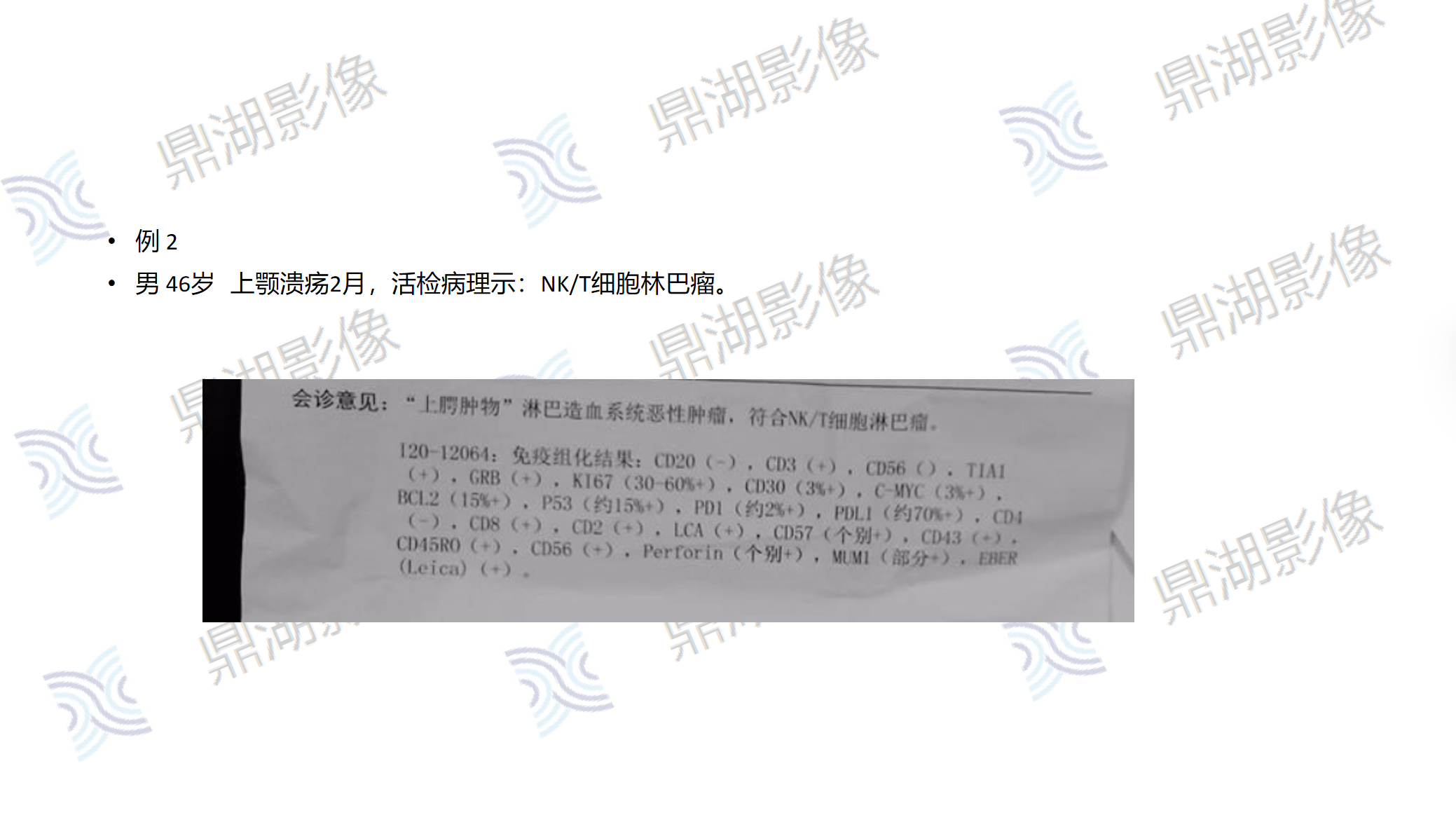 b4e45544629fa31d7d5d2765c20796ed.png b4e45544629fa31d7d5d2765c20796ed.png