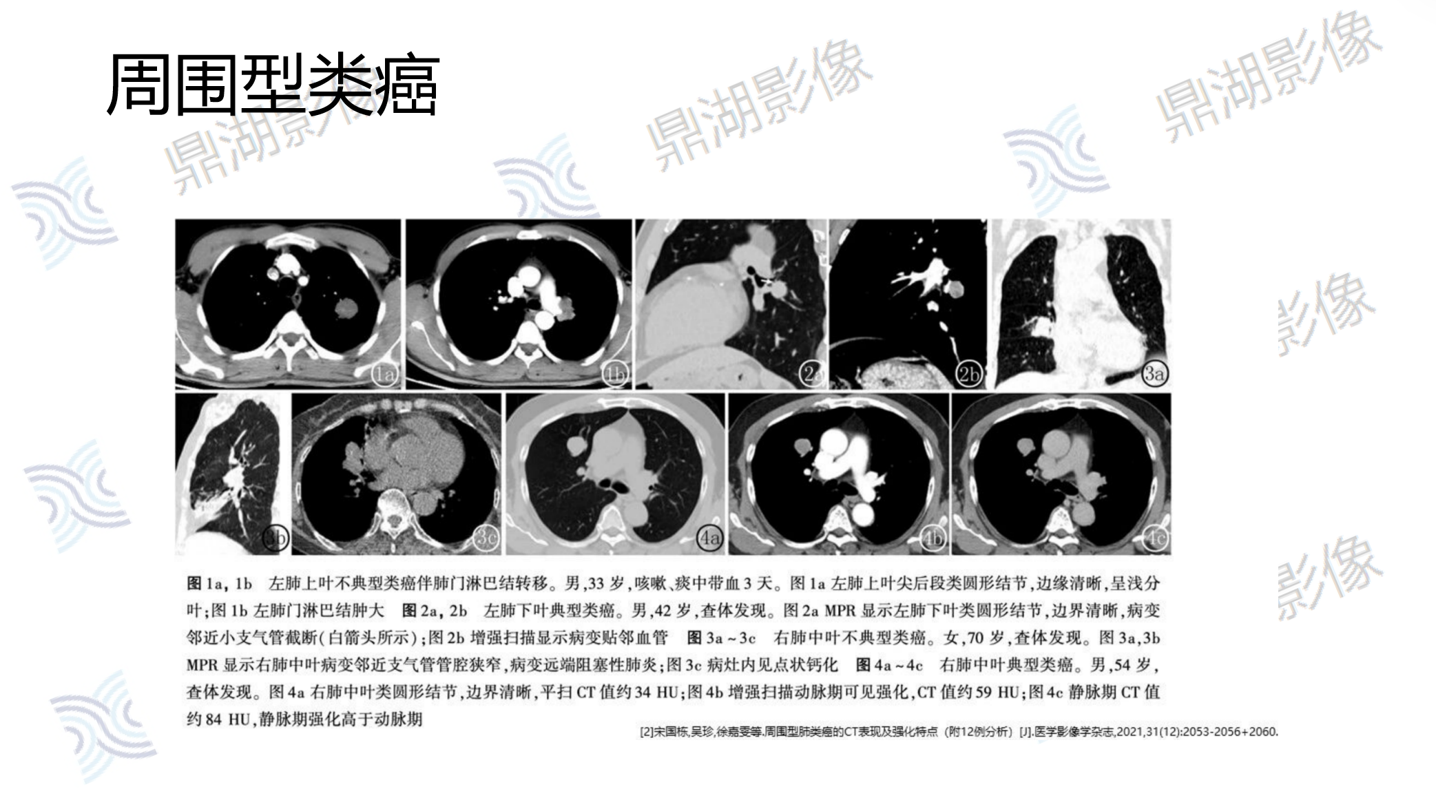 cb21ad453e250916987d3988ec6b55a7.png