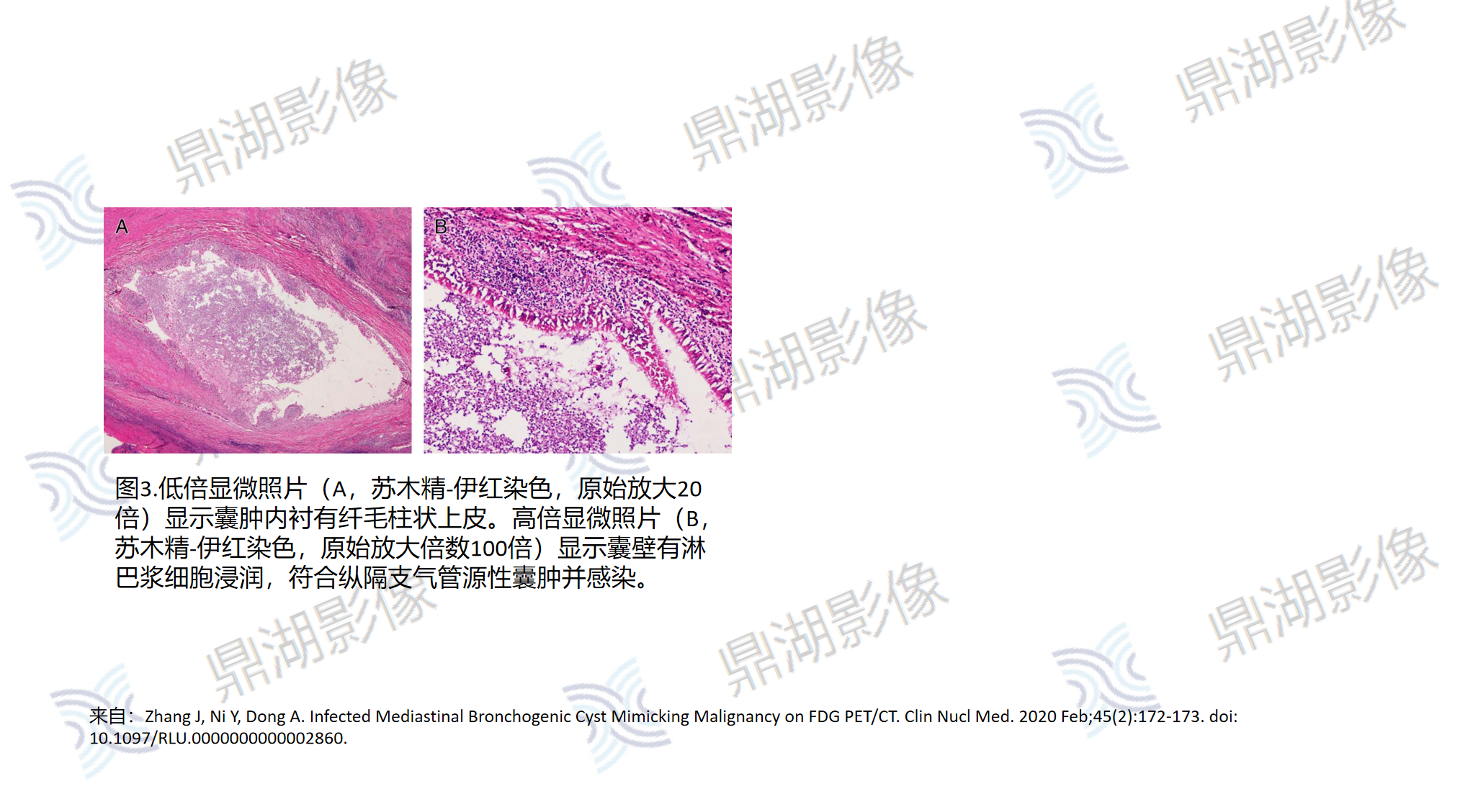 f9476efd810f52e9775a0b27dc16b042.png f9476efd810f52e9775a0b27dc16b042.png