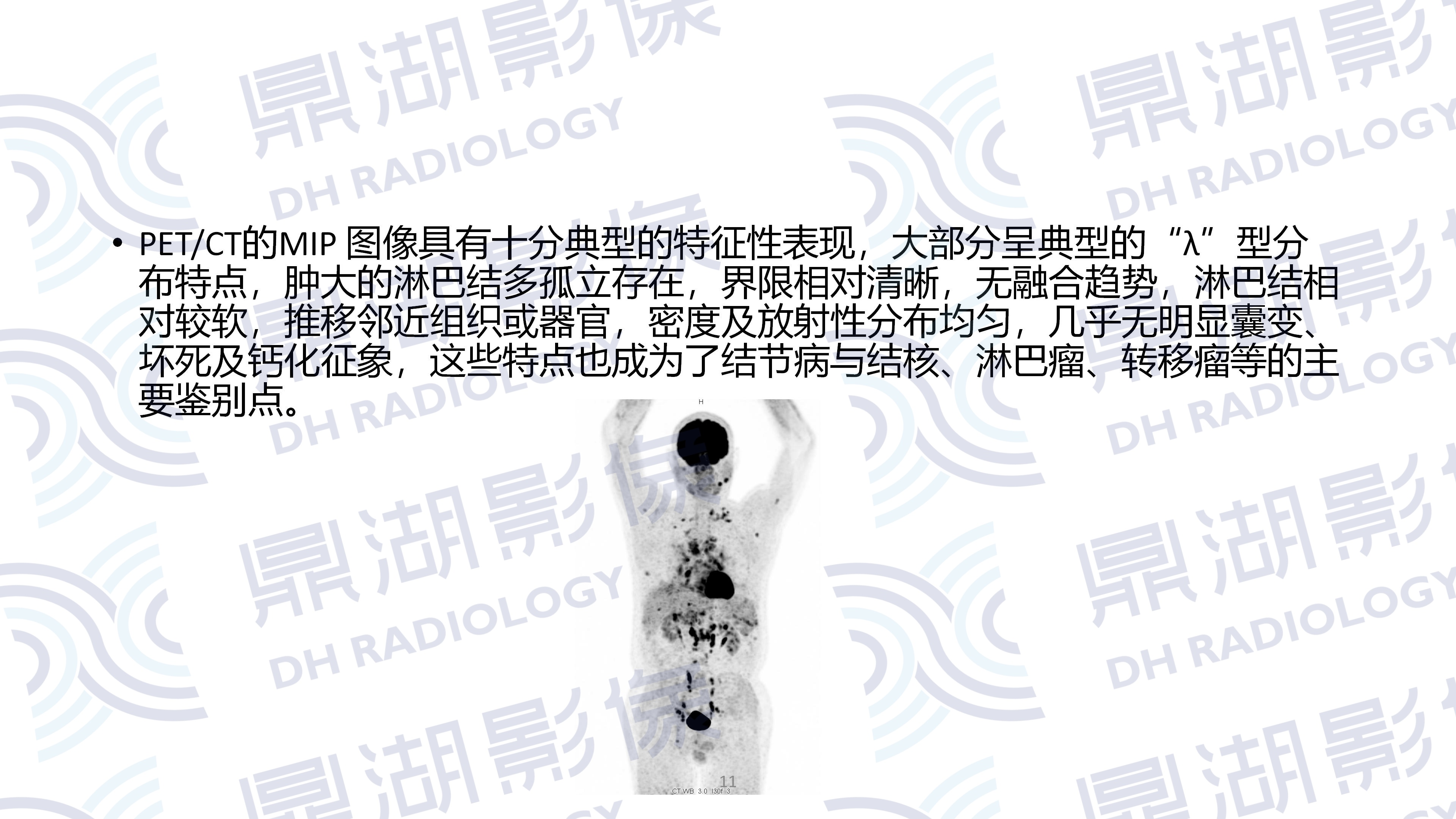 5b0039261a17a0c62e709a843a90ebbd.jpg