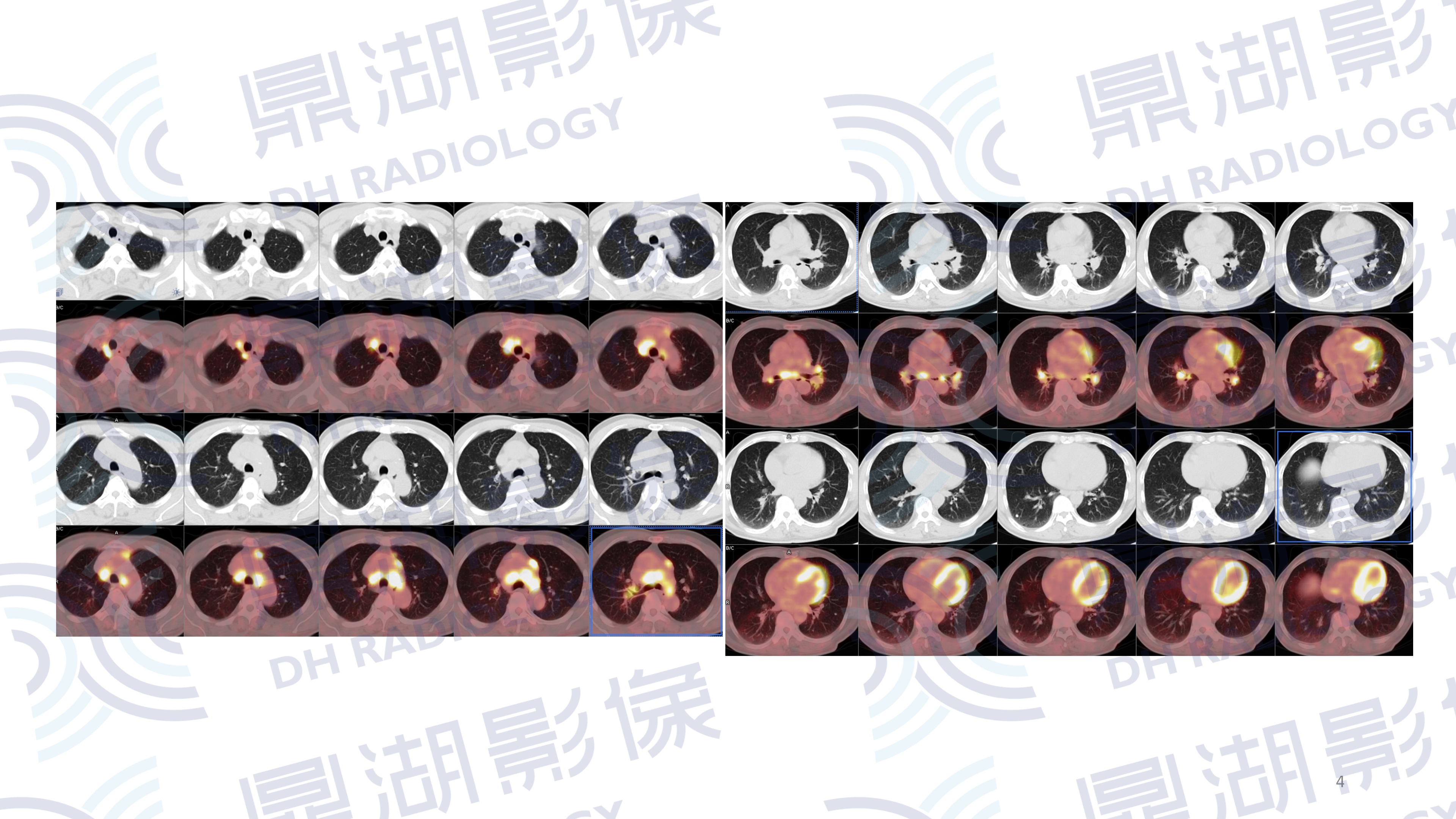 73c94258cbce7f05d73054227290d952.jpg 73c94258cbce7f05d73054227290d952.jpg