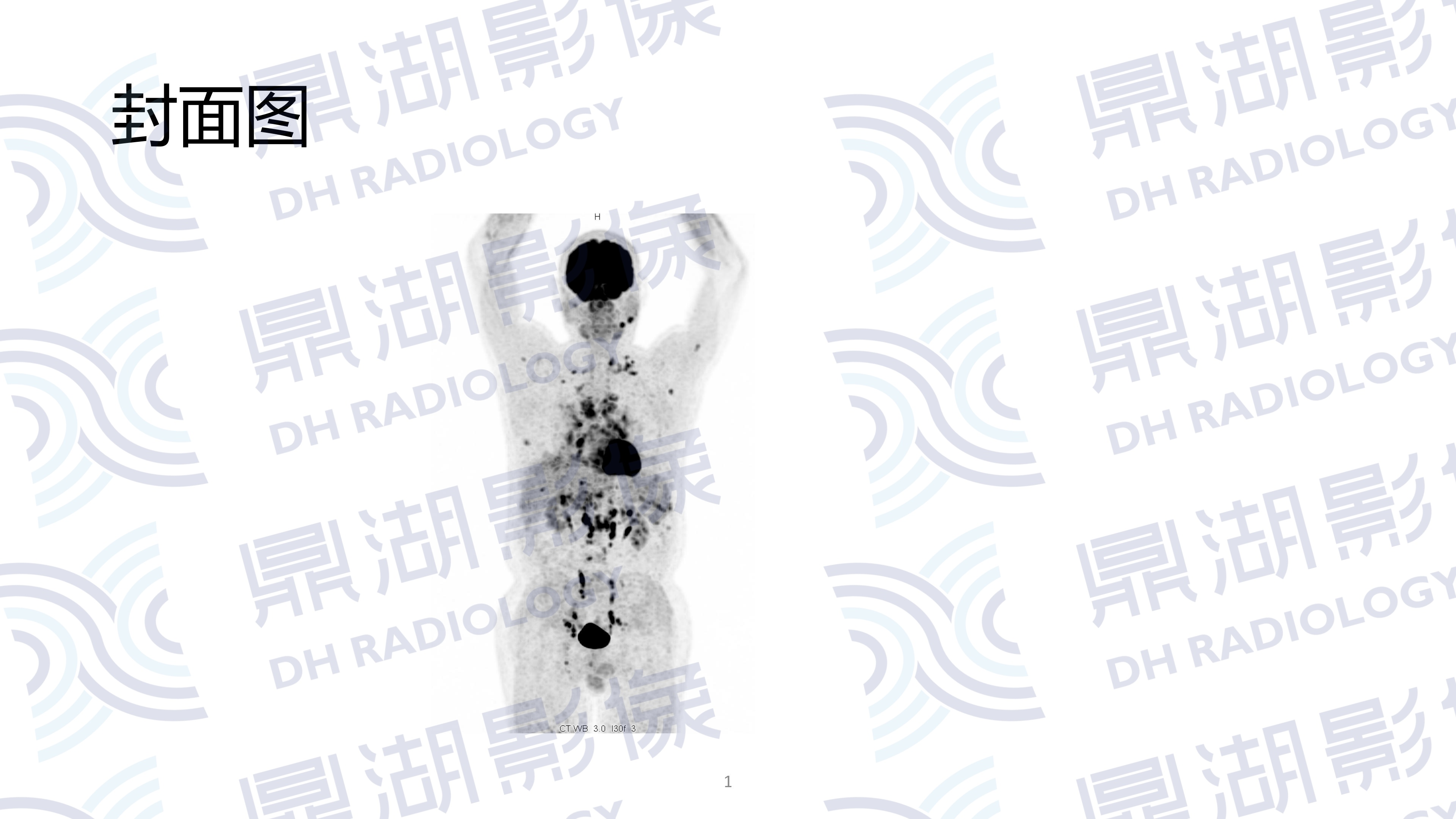 fdf15ec98dc704198bf31b9e1fc52265.jpg