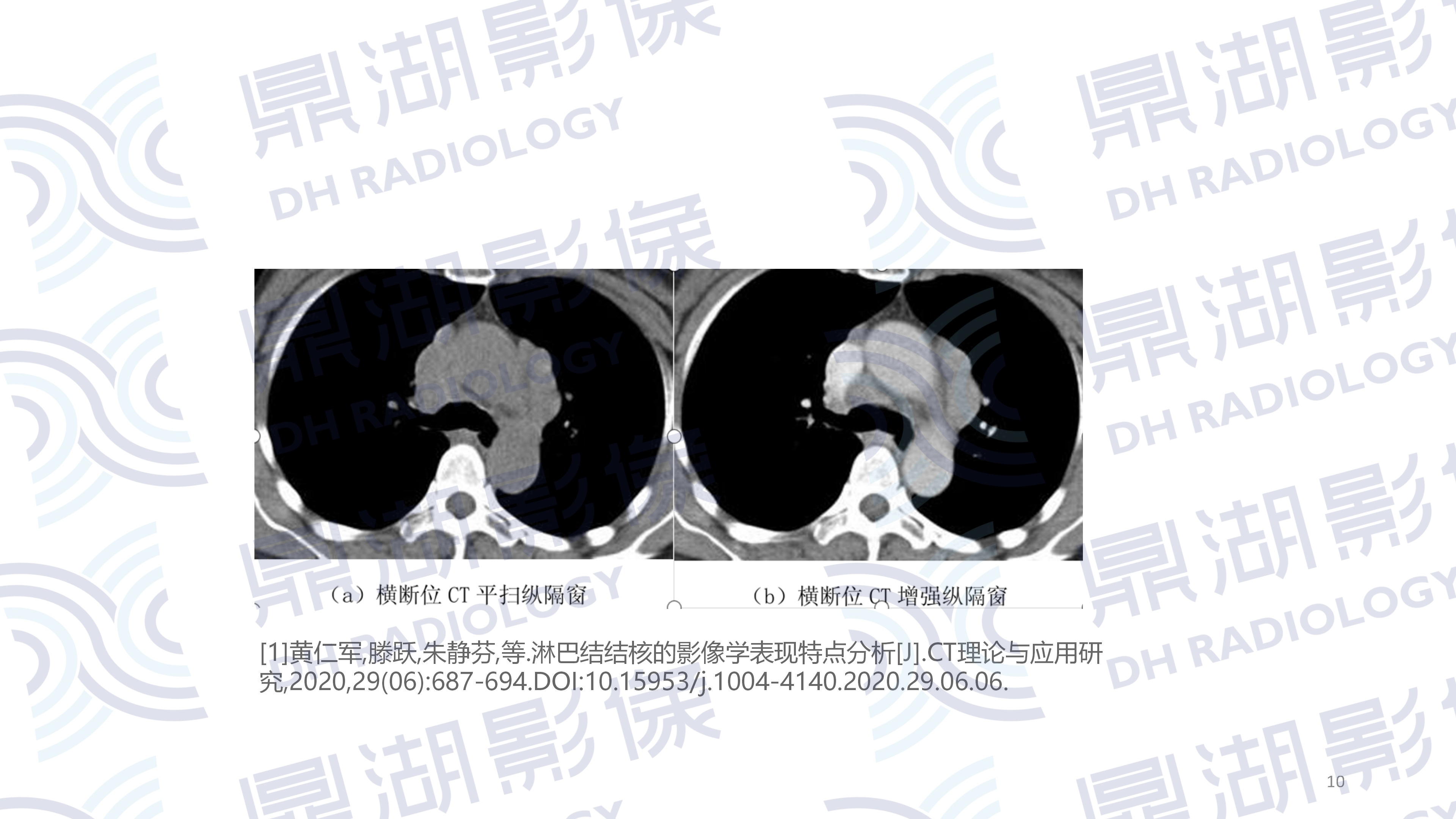 b277ae96415d2509e11889bbbe4c6be0.jpg