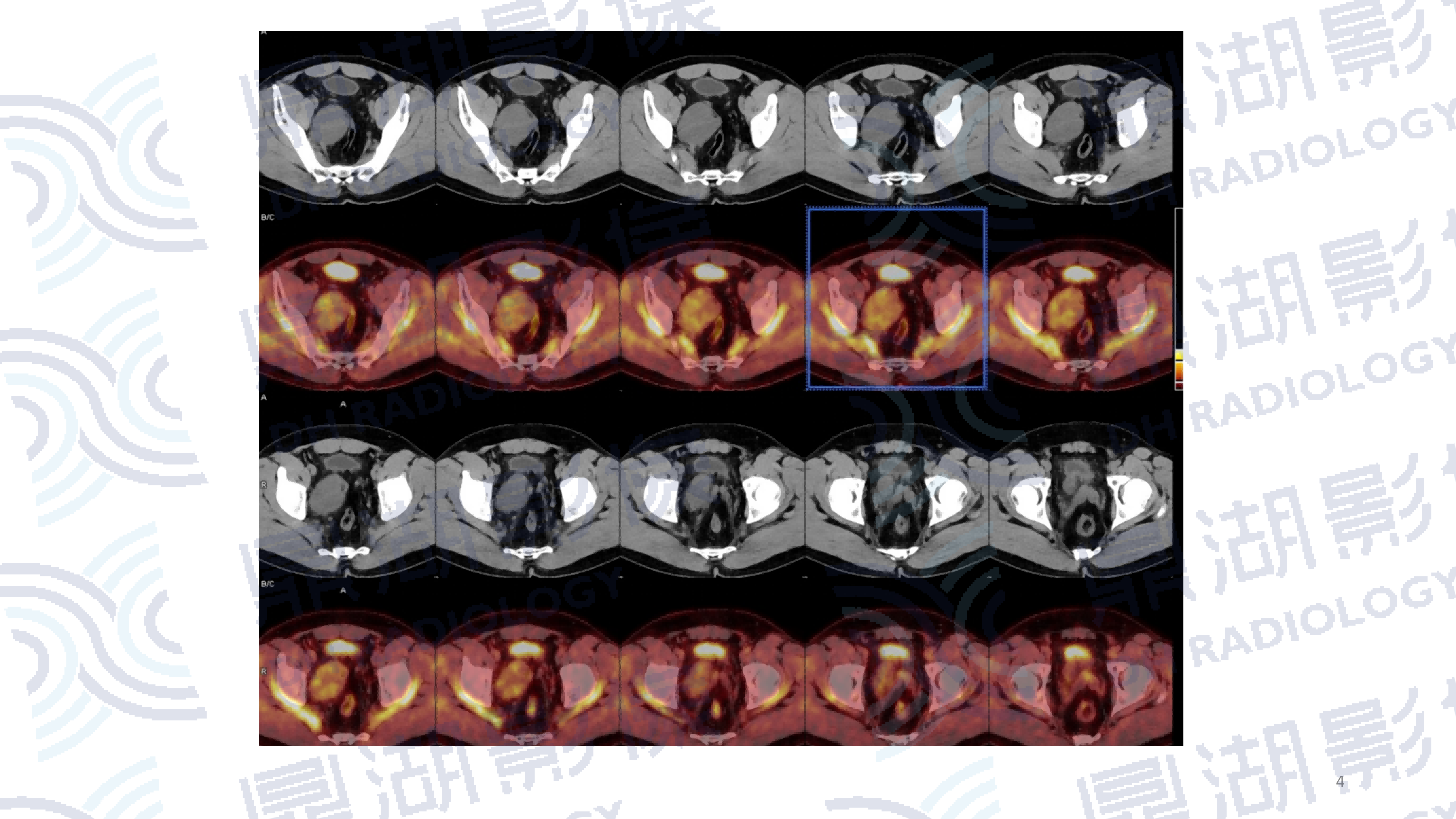 008a9f669bd271d3c7f6b7a1d142d1e1.png