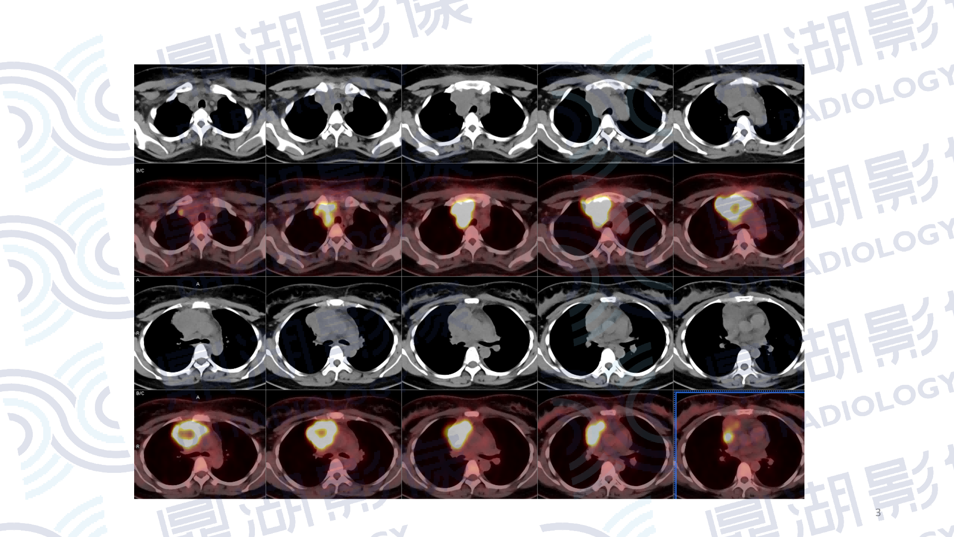 3648adabf78bb832b9b4e4581cacfdaa.png