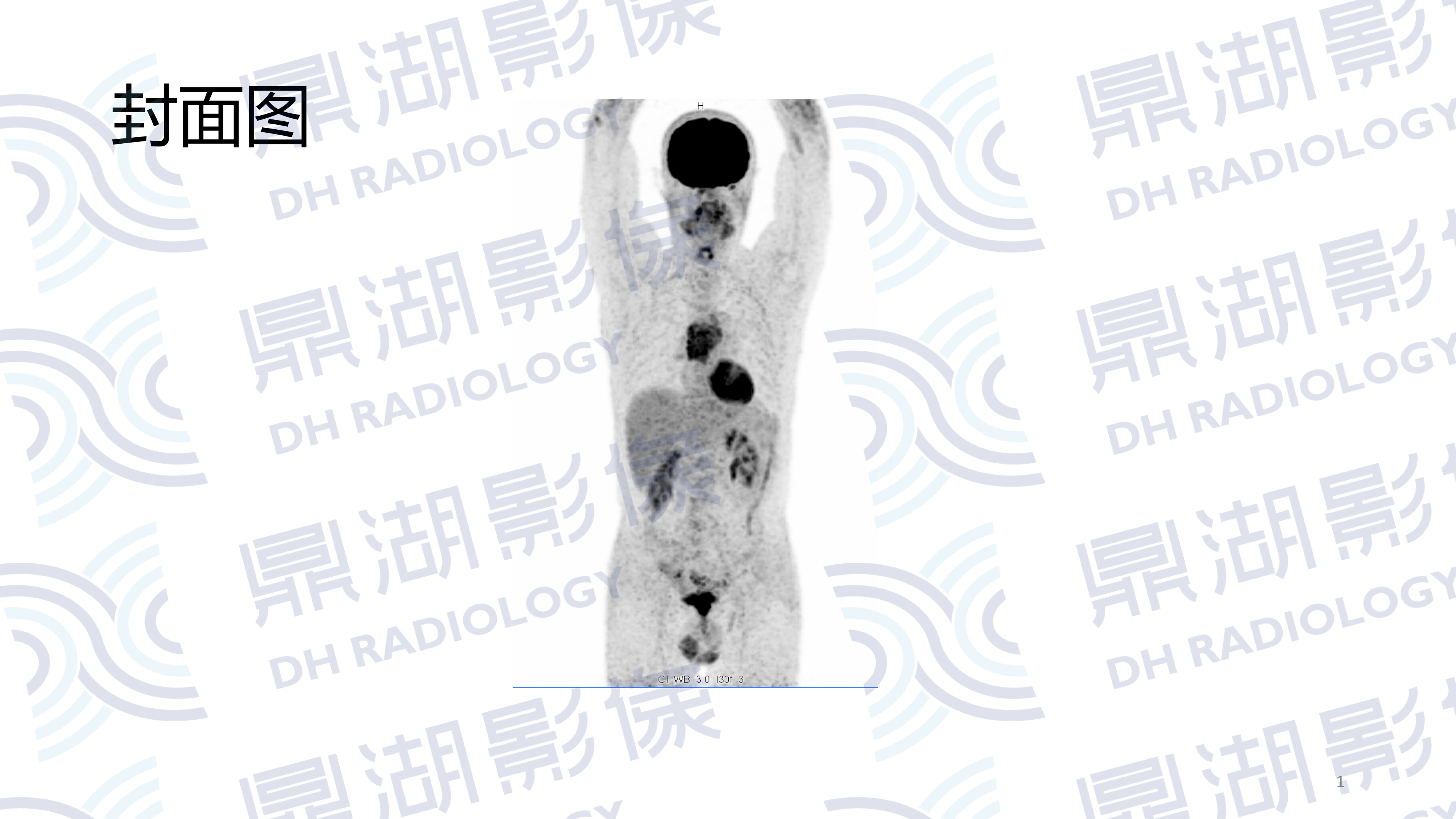 72f30de68aacec7ca8e4a95e5c5e3ee2.png