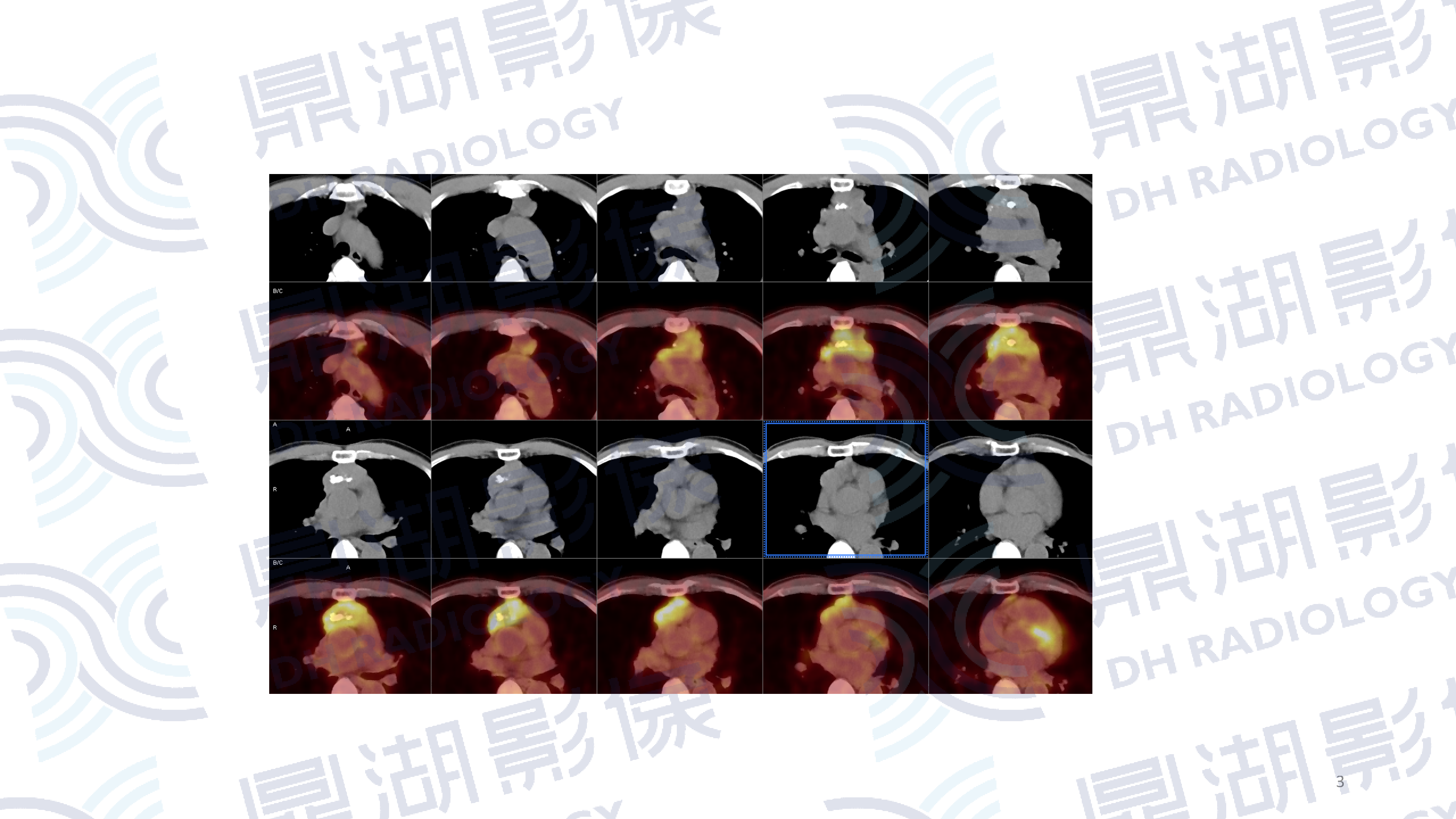 9479d3a5b1b5ee9ba0122db611cc6a7b.png