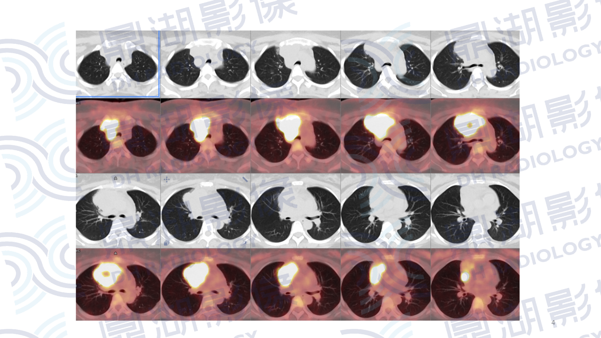 d50518eef33464d5377ff994fc6e12bf.png