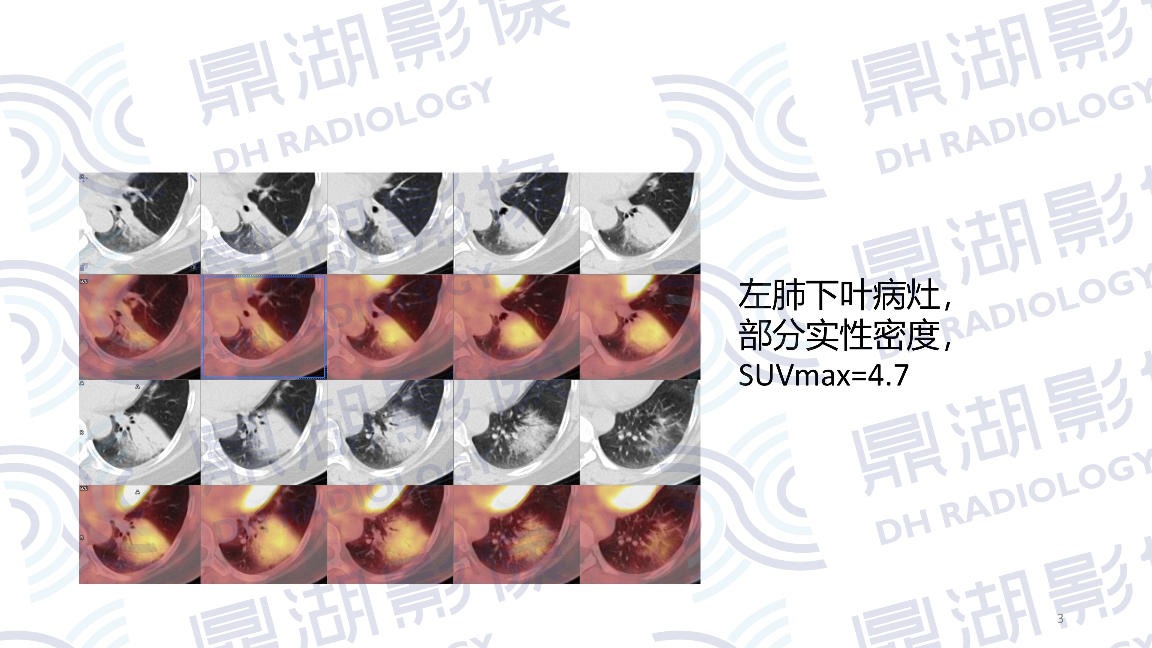 05394c9447fb0d82bc232a9bfc3f0b67.jpg