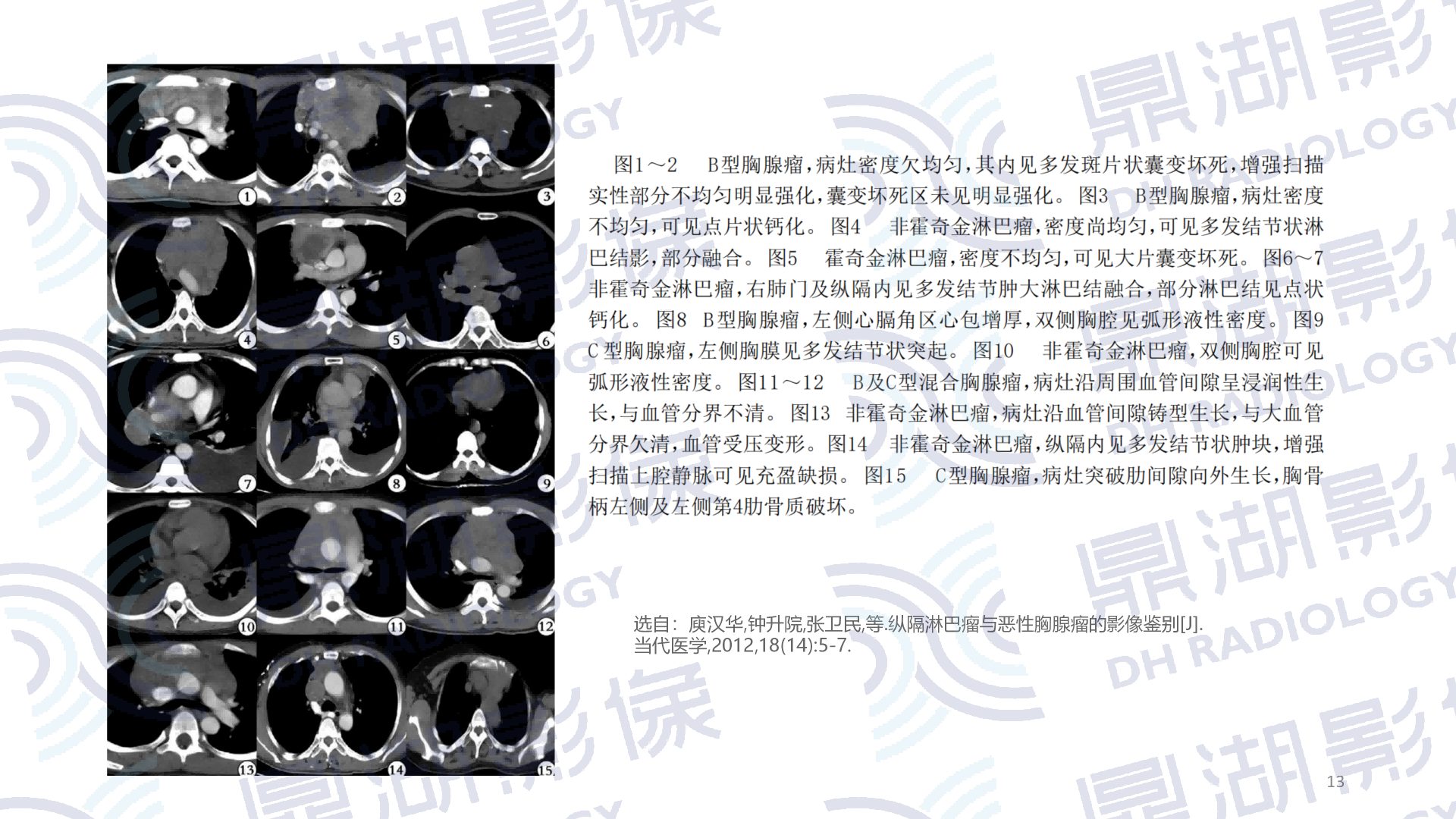 ca9451281eba7a8a1e37cd2aee0d40a7.png