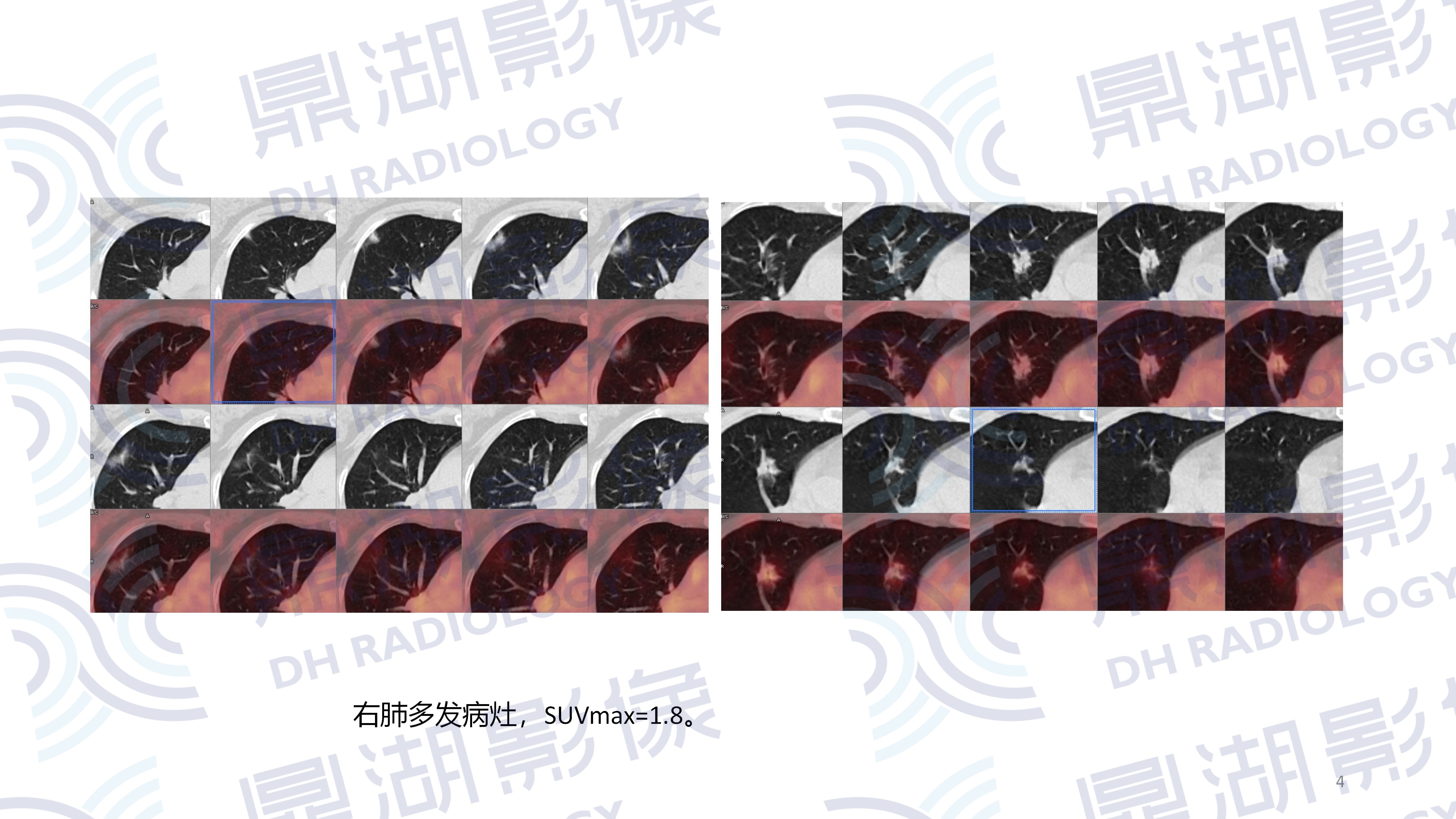 59a6bcccc8fde9b5bf9f3f112673dea1.jpg
