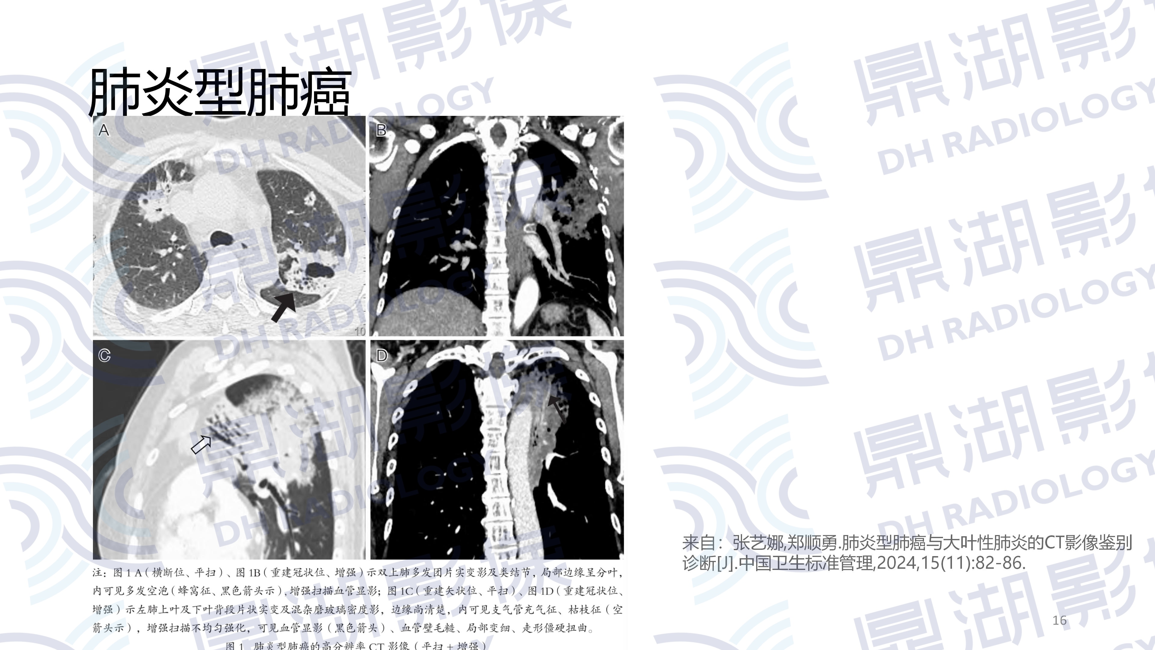 e175facd88a946cf6dd177cdf15c6da9.jpg