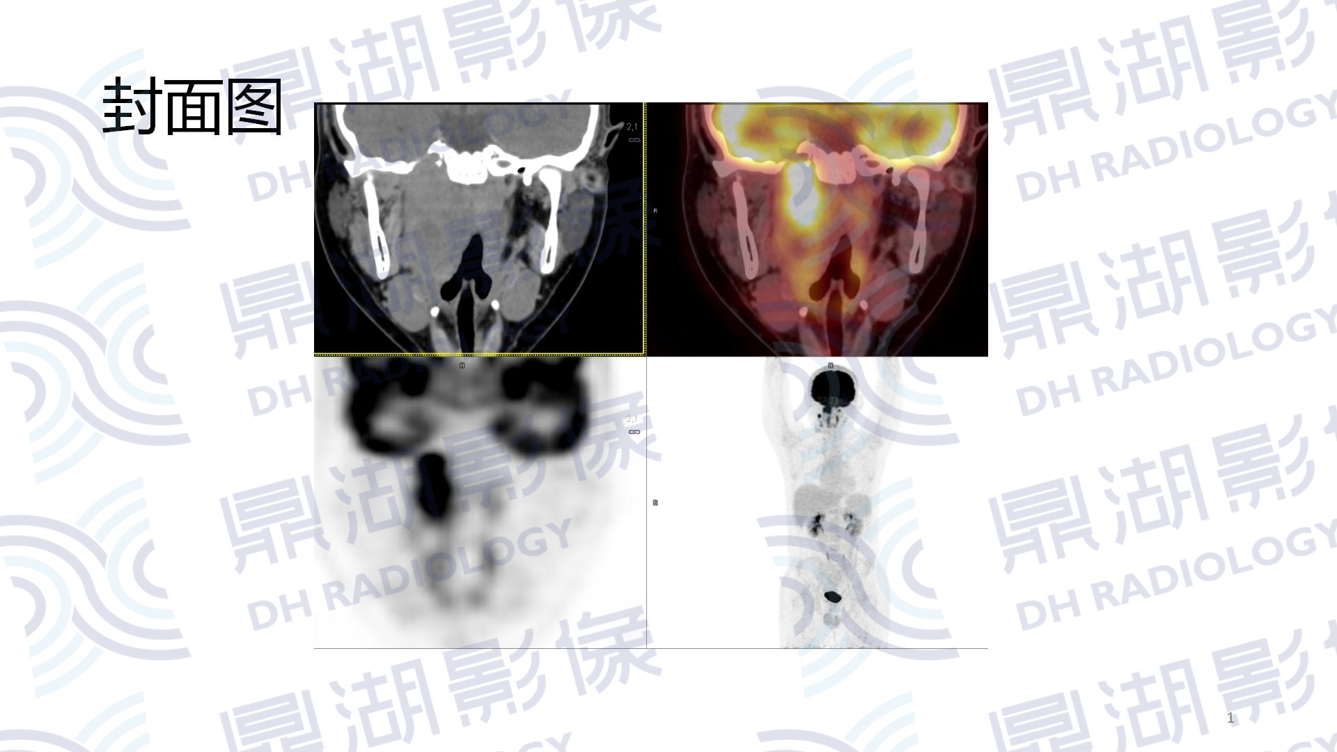 45ba43335245ee86ec464290b5b468e8.jpg