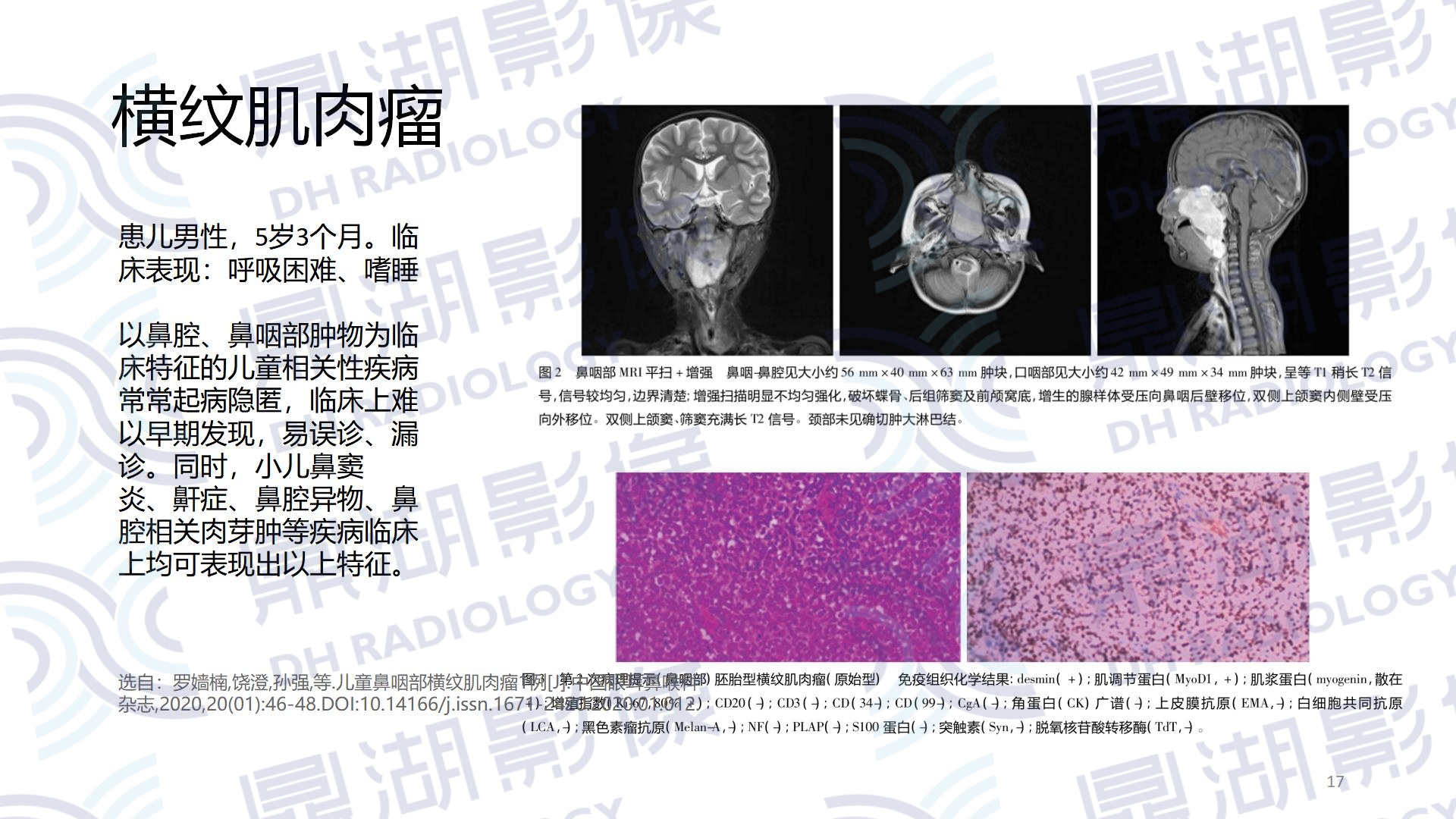 922b80bb1a81120d18e06bc23cd83ba7.jpg