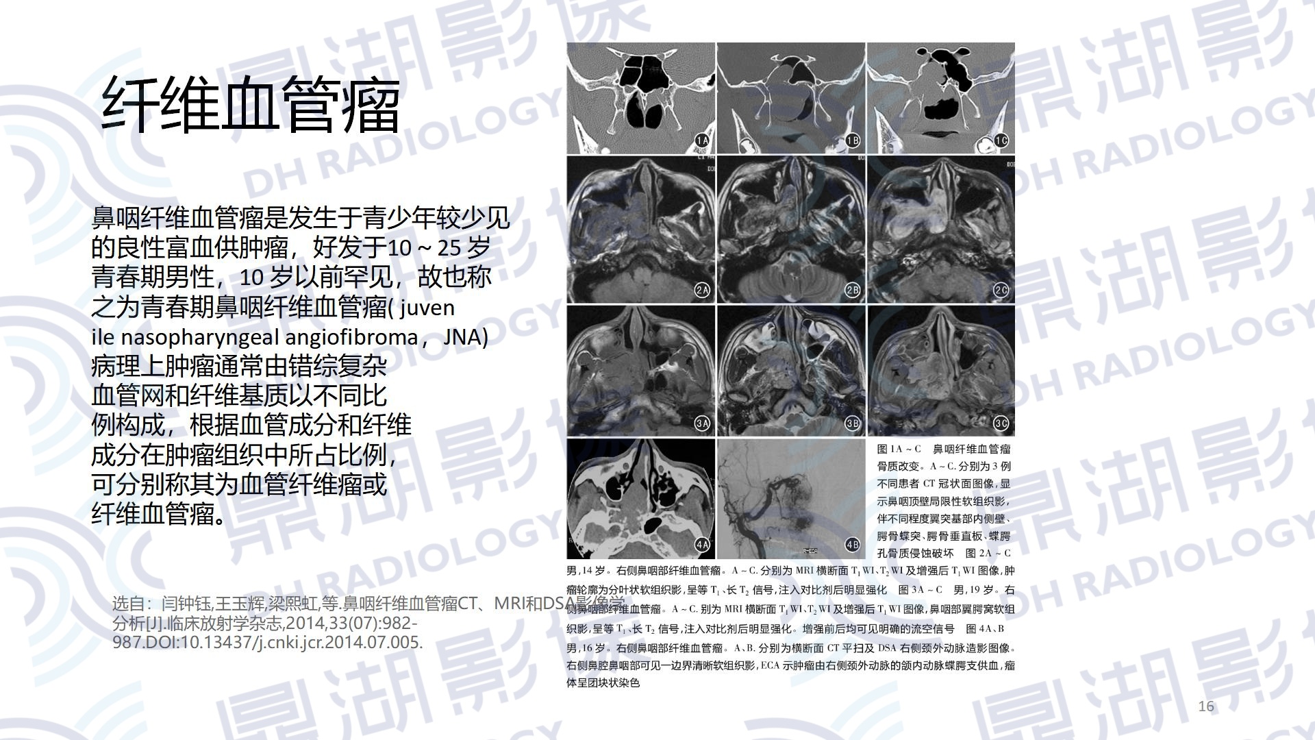 d1af7bac88af4dbb8e95586935f78a32.jpg