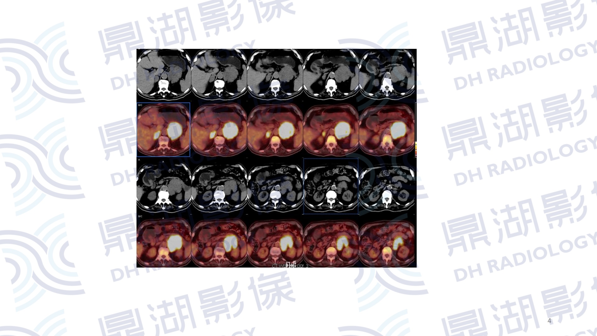 5ad928cc8f2bab8f20c871afb40a19d9.jpg