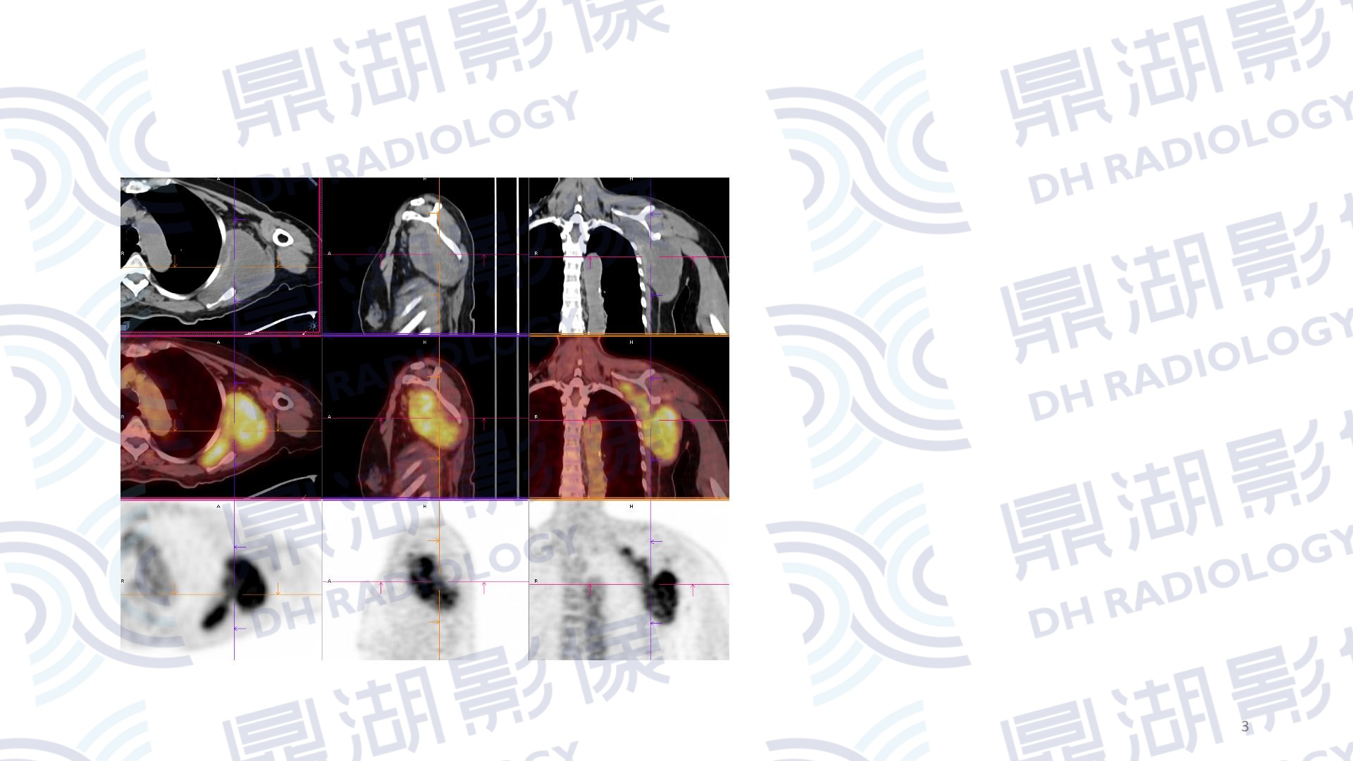 885cc8cb8021995b8a80a0461560e621.jpg